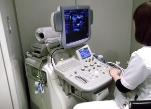 頚動脈エコー検査機械の画像